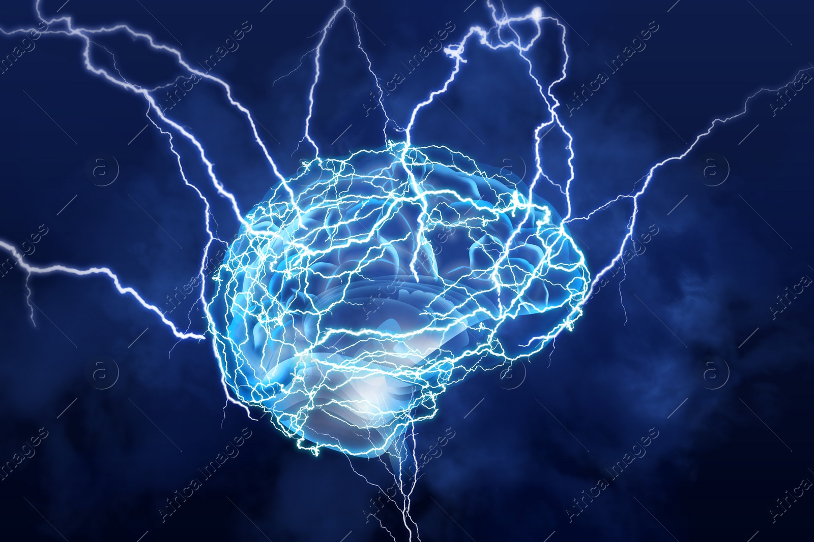 Illustration of  human brain with lightning strikes on blue background