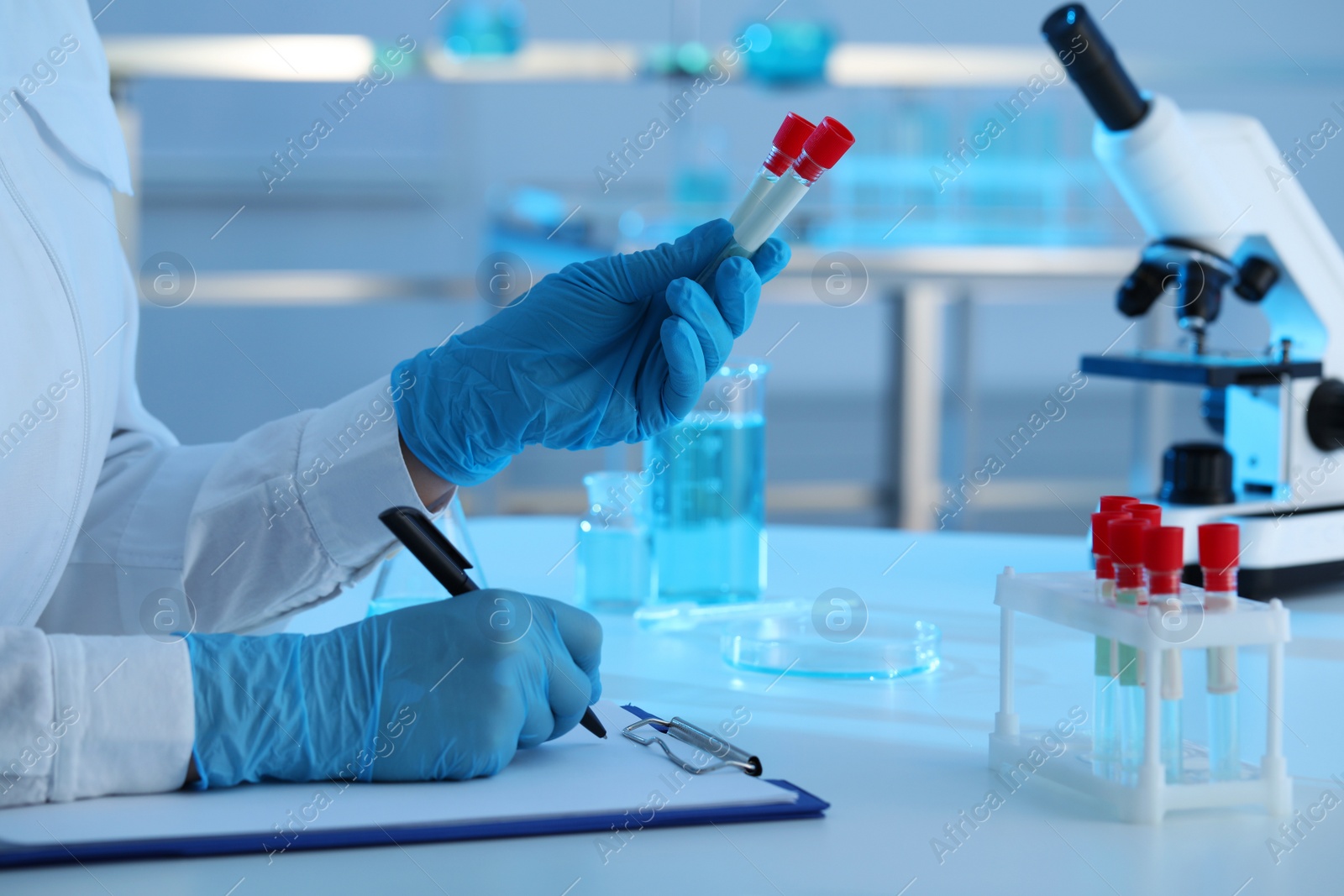 Photo of Scientist working with samples in laboratory, closeup. Medical research