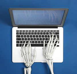 Human skeleton using laptop on blue background, top view