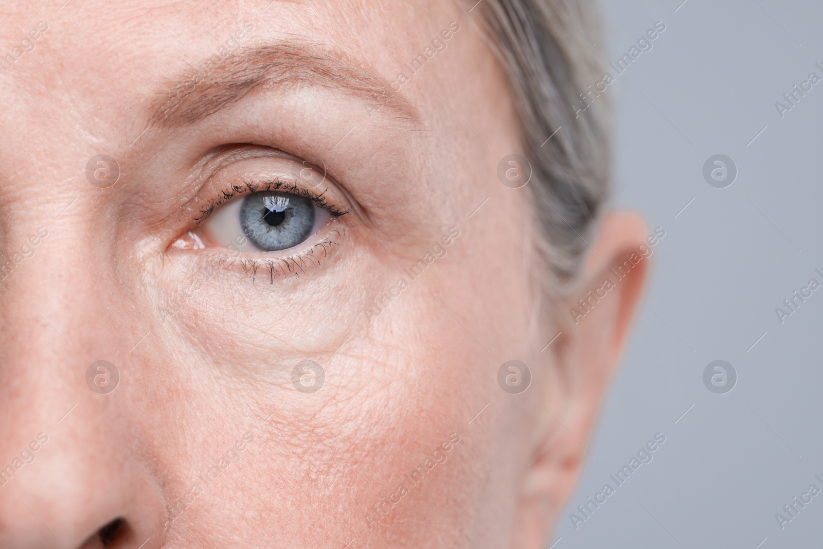 Photo of Senior woman with aging skin on grey background, closeup. Rejuvenation treatment