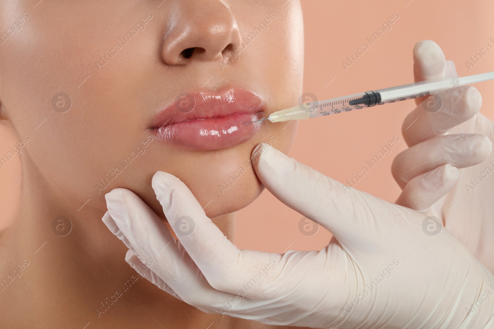 Photo of Young woman getting lips injection on peach background, closeup