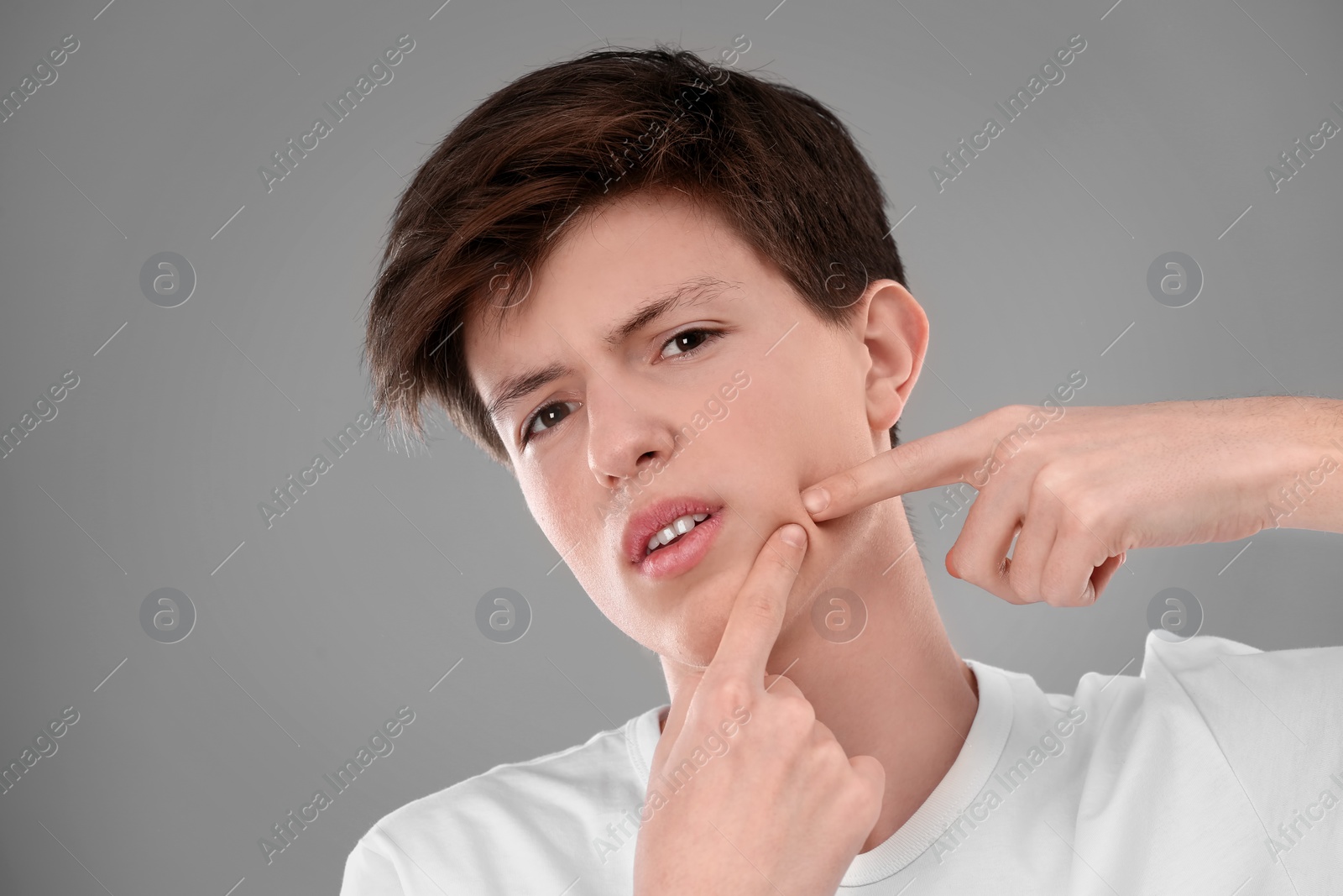 Photo of Teenage boy with acne problem on grey background