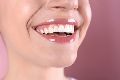 Young woman with healthy teeth and beautiful smile on color background, closeup