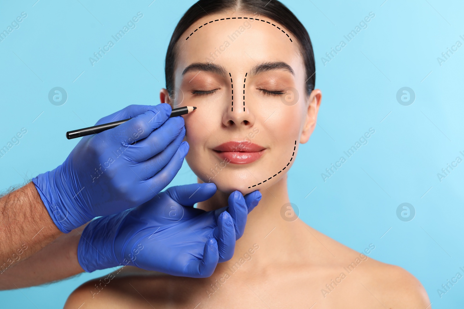 Image of Woman preparing for cosmetic surgery, light blue background. Doctor drawing markings on her face, closeup