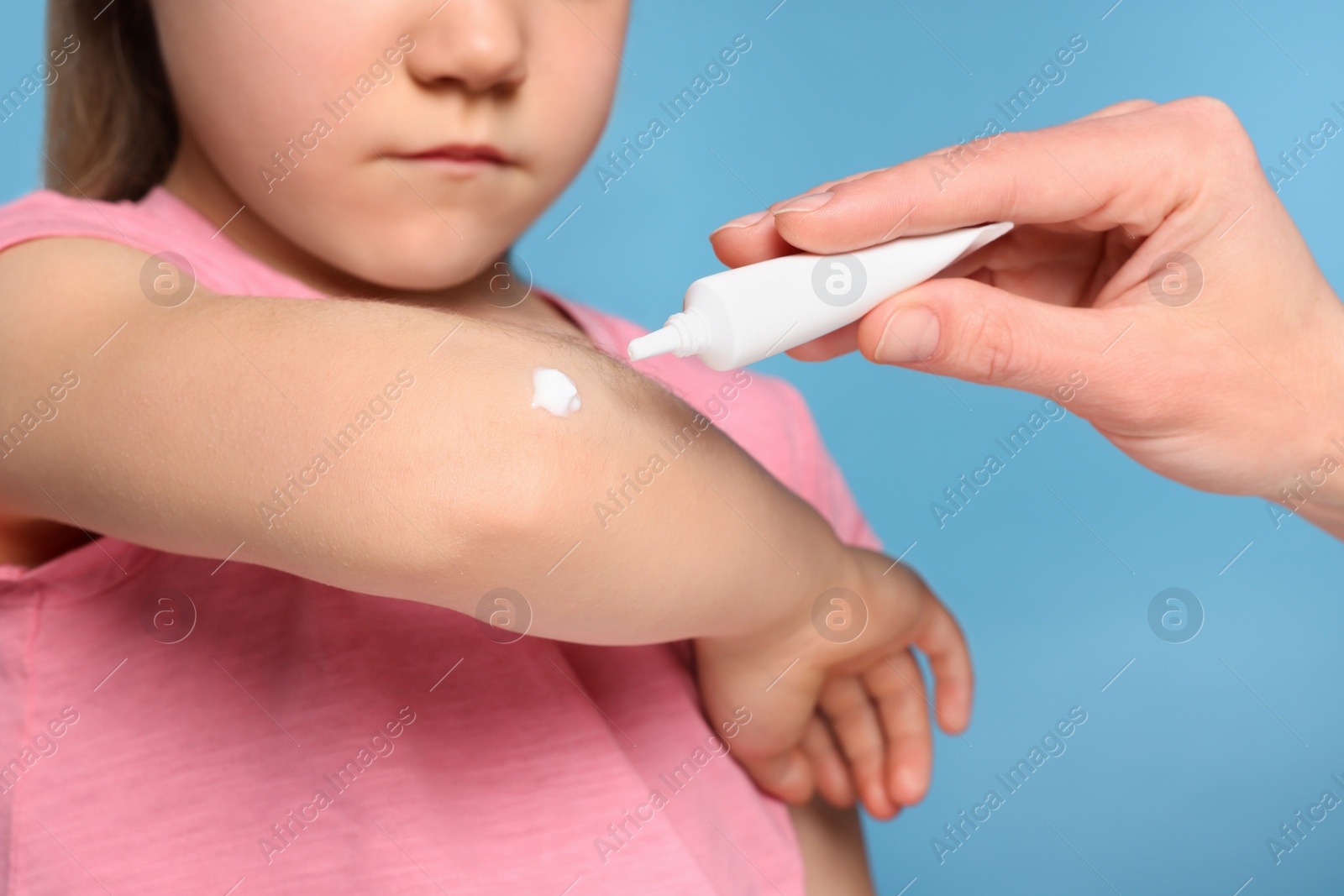 Photo of Mother applying ointment onto her daughter's elbow on light blue background, closeup