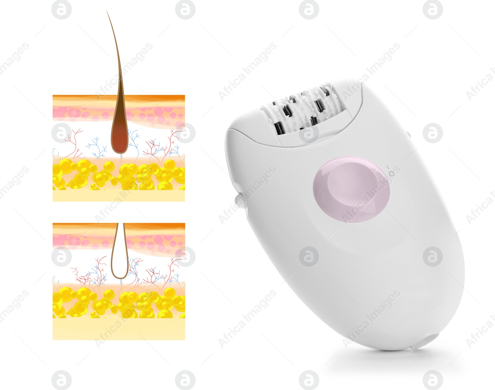 Image of Epilation procedure. Modern appliance and illustrations of hair follicle on white background
