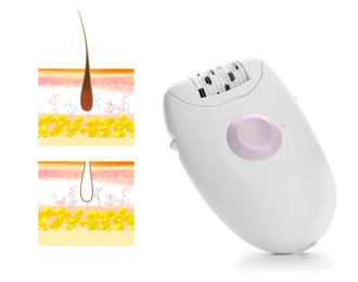 Image of Epilation procedure. Modern appliance and illustrations of hair follicle on white background
