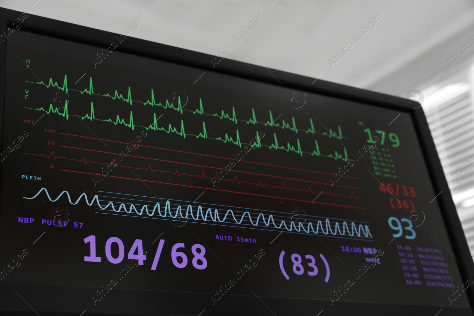 Photo of Black monitor with cardiogram in hospital, closeup