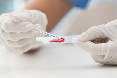 Photo of Scientist dripping blood sample on glass in laboratory