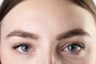 Photo of Closeup view of woman with dry skin