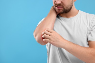Photo of Allergy symptom. Man scratching his arm on light blue background, closeup. Space for text
