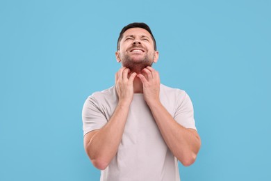 Photo of Allergy symptom. Man scratching his neck on light blue background