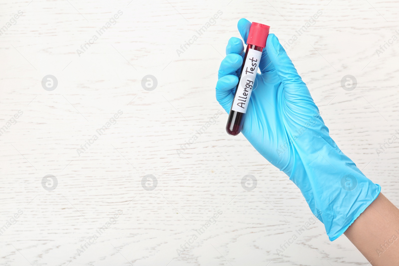 Photo of Doctor holding tube with blood and space for text on light background, top view. Allergy test