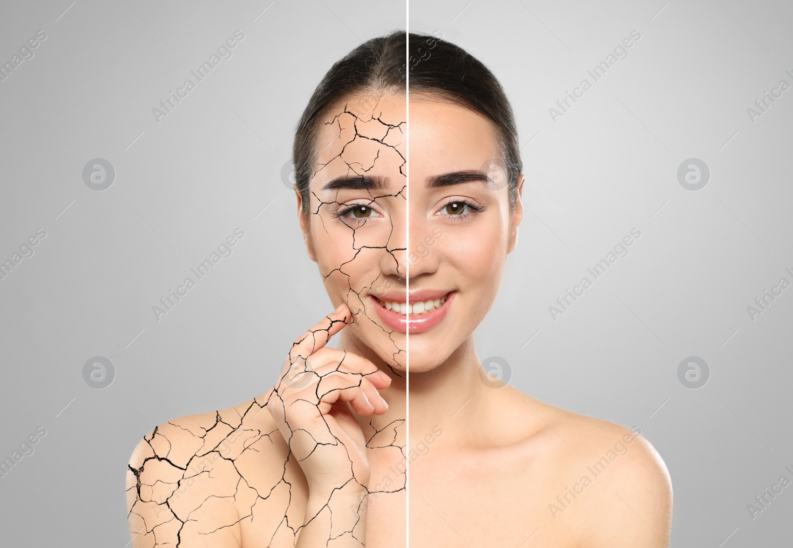 Image of Collage with photos of woman having dry skin problem before and after dry skin problem on light grey background