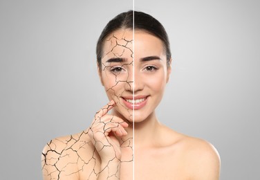 Collage with photos of woman having dry skin problem before and after dry skin problem on light grey background
