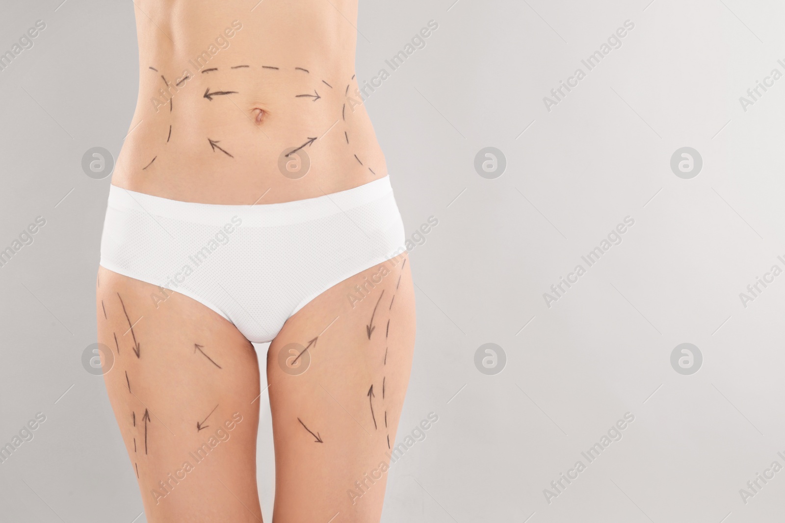 Photo of Woman with marks on body for cosmetic surgery operation against grey background, closeup