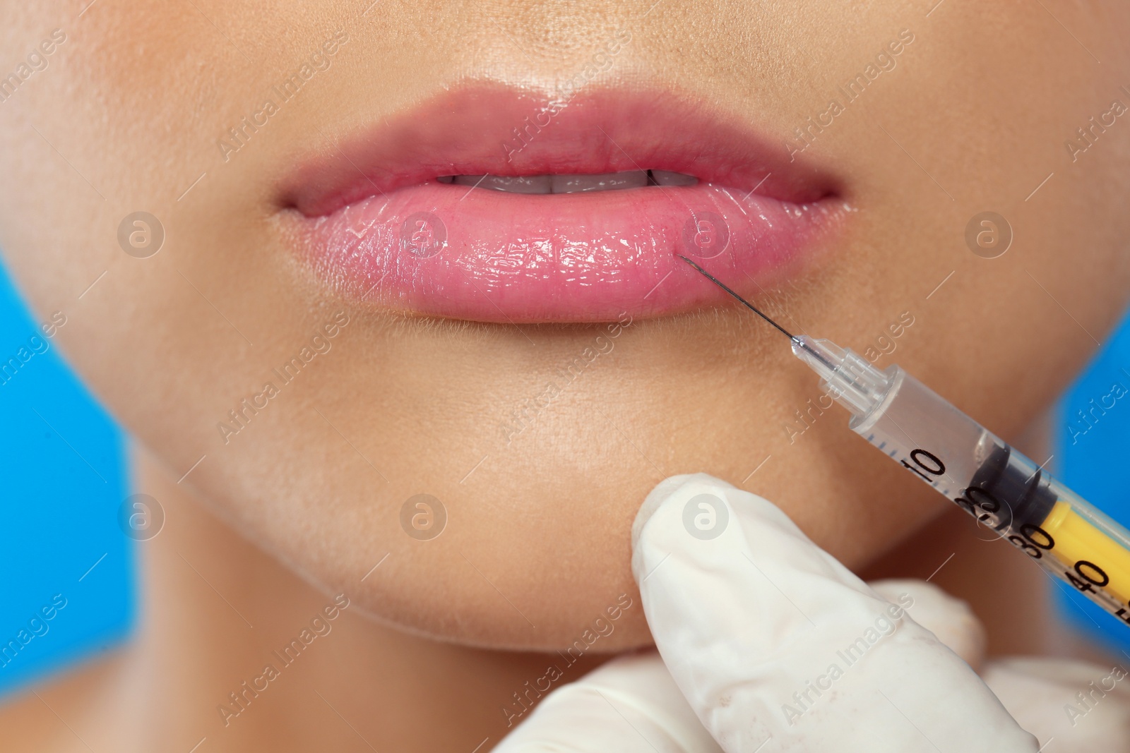 Photo of Young woman getting lips injection, closeup. Cosmetic surgery