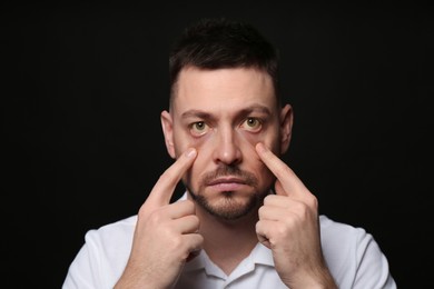 Photo of Man checking his health condition on black background. Yellow eyes as symptom of problems with liver
