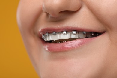 Photo of Smiling woman with dental braces on orange background, closeup