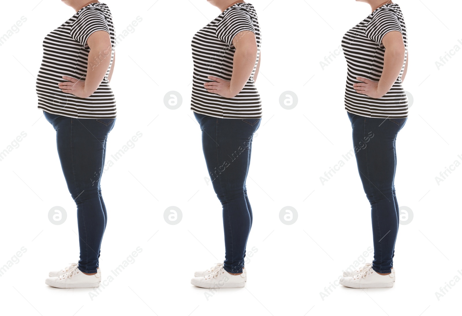 Image of Collage with photos of overweight woman before and after weight loss on white background,closeup