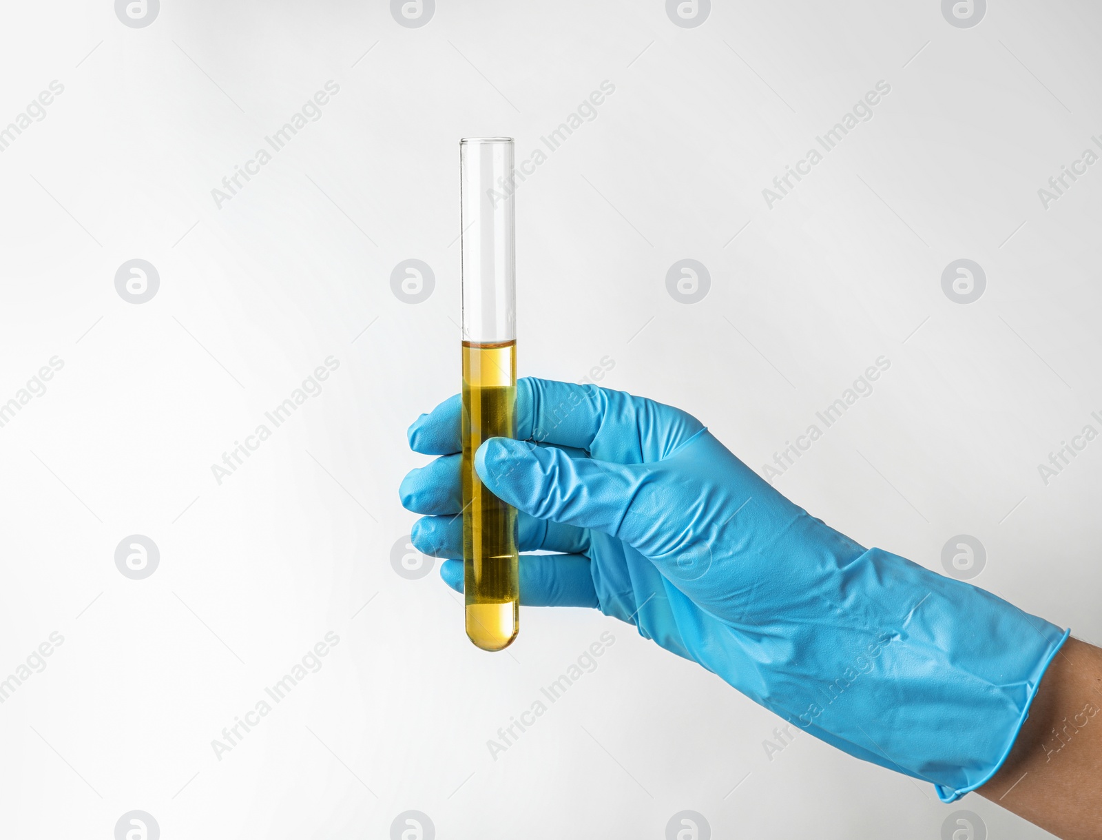 Photo of Laboratory worker holding test tube with urine sample on light background. Urology concept