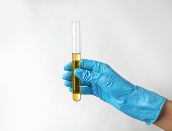 Laboratory worker holding test tube with urine sample on light background. Urology concept