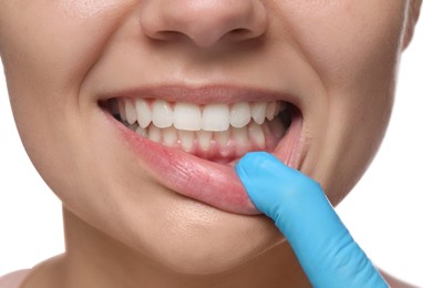 Woman showing healthy gums on white background, closeup