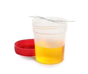 Container with urine sample for analysis and test strips on white background