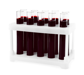 Test tubes with blood samples in rack on white background. Laboratory analysis