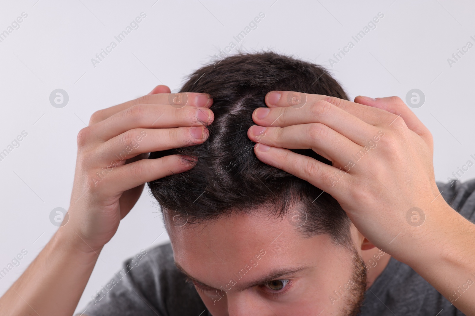 Photo of Man examining his hair and scalp on white background, closeup