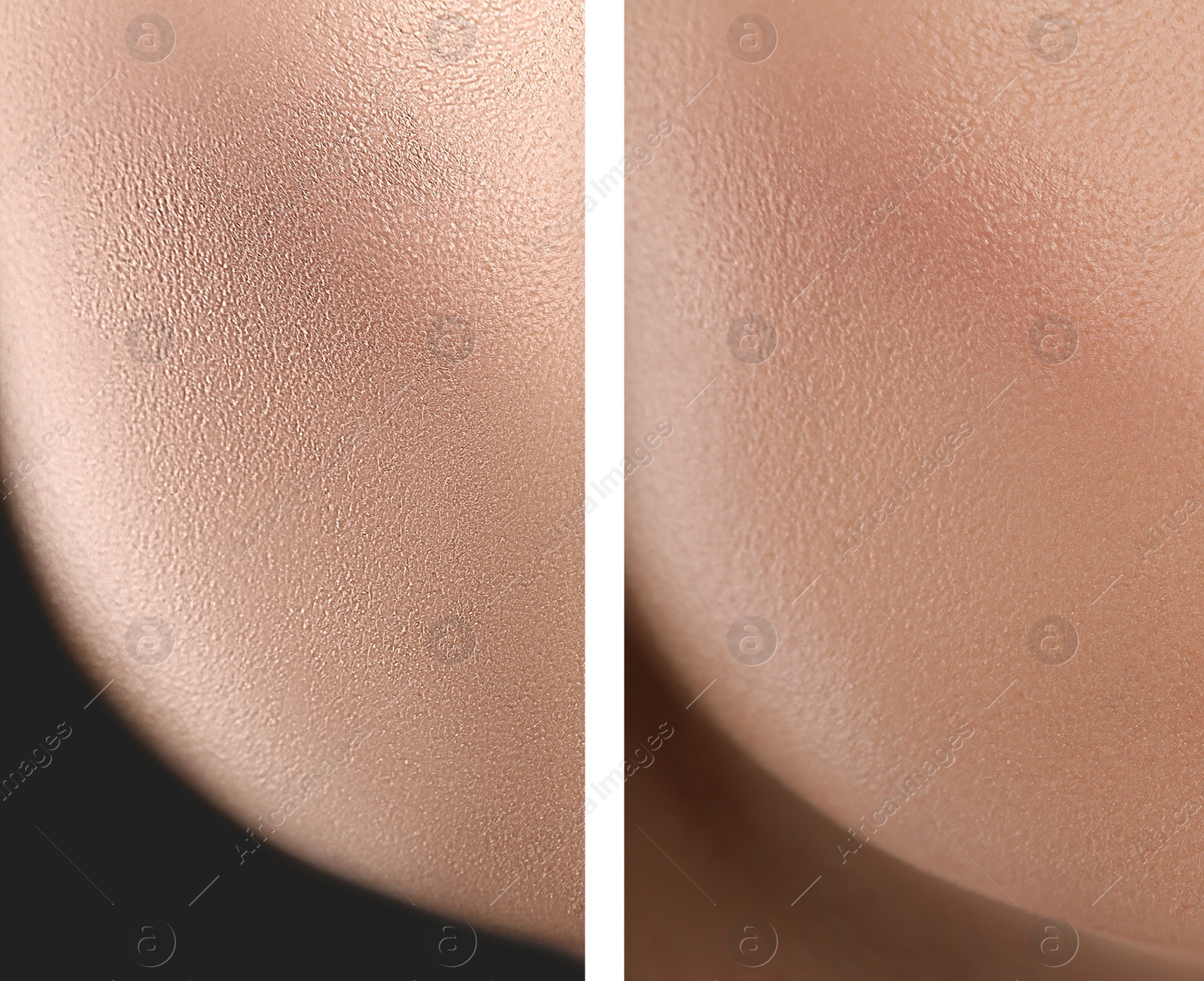 Image of Collage with photos of dry and moisturized skin texture