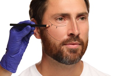 Man preparing for cosmetic surgery, white background. Doctor drawing markings on his face, closeup