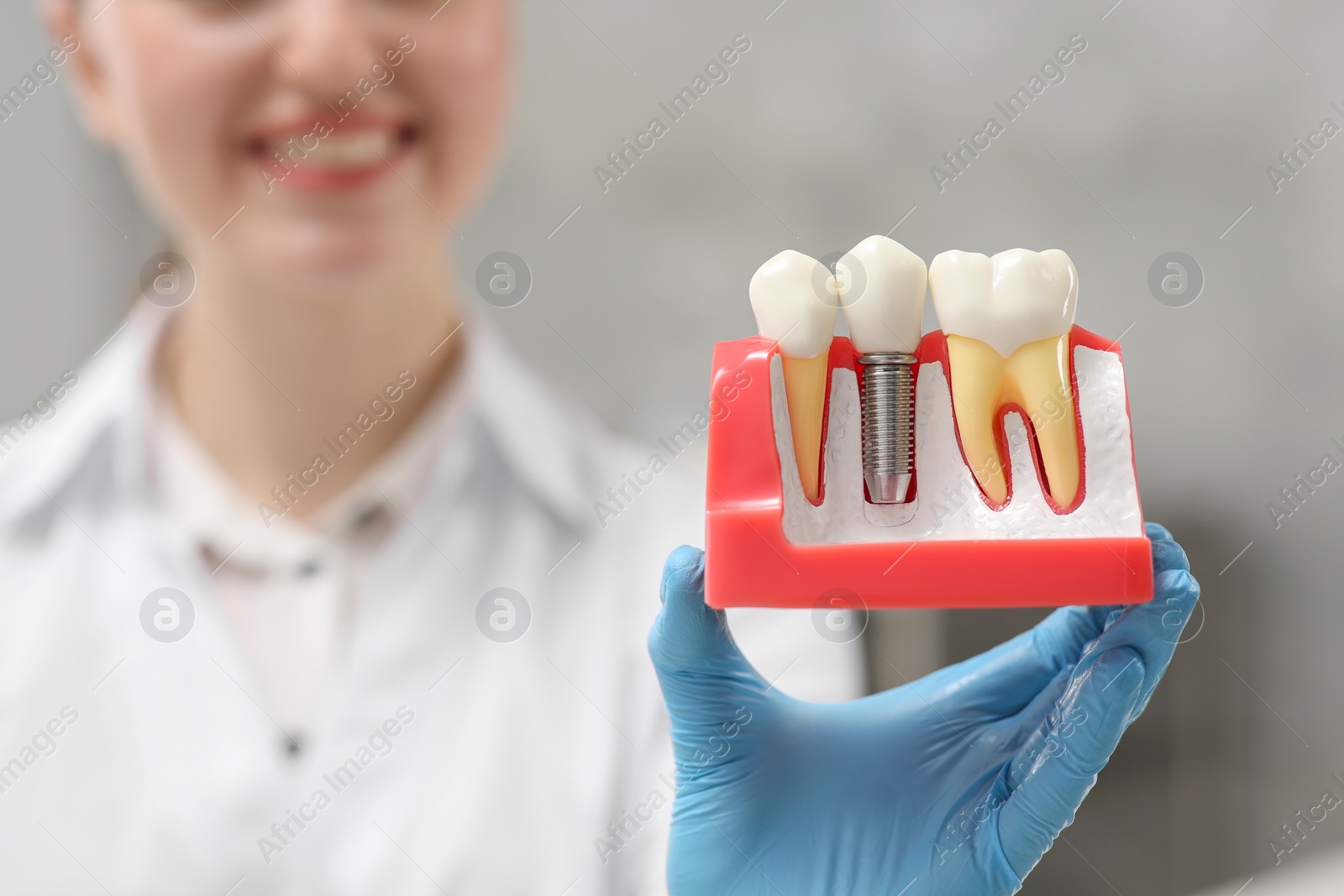 Photo of Dentist holding educational model of dental implant on blurred background, closeup. Space for text