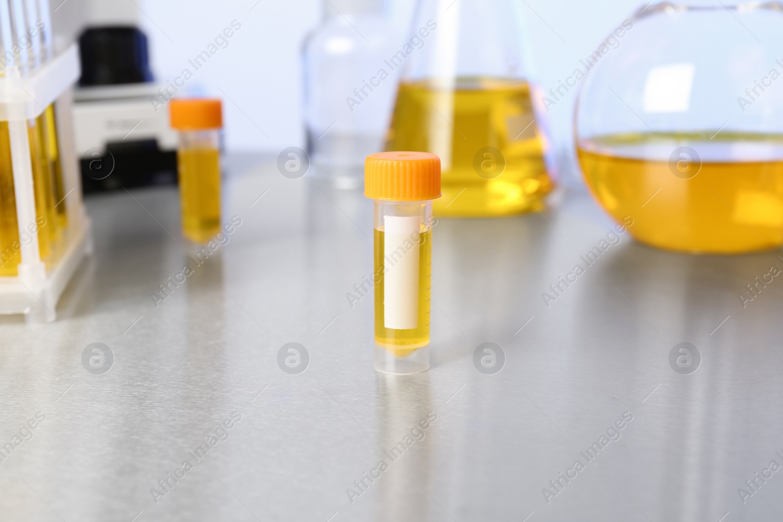 Photo of Container with urine sample for analysis on table in laboratory