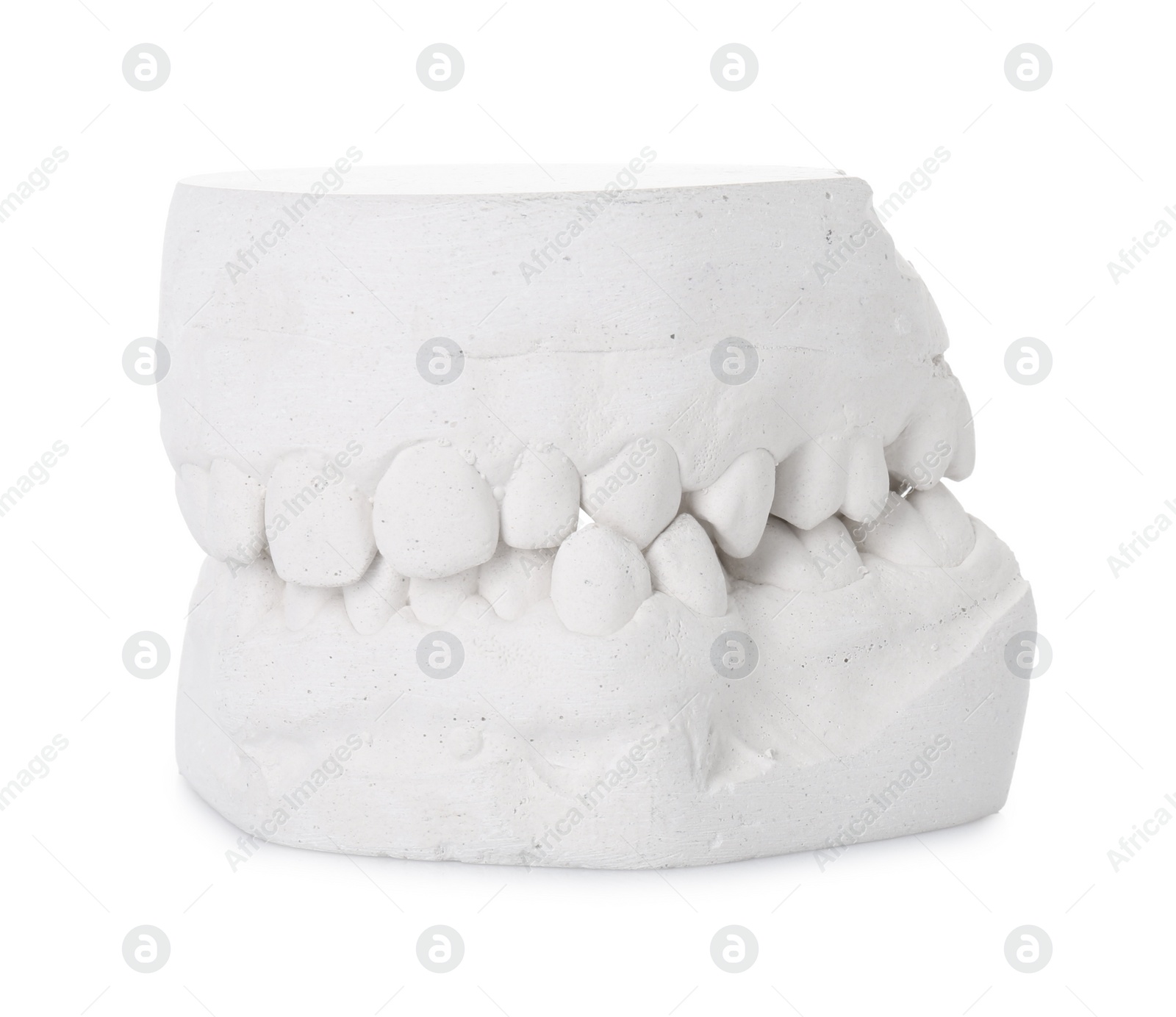 Photo of Dental model with gums isolated on white. Cast of teeth