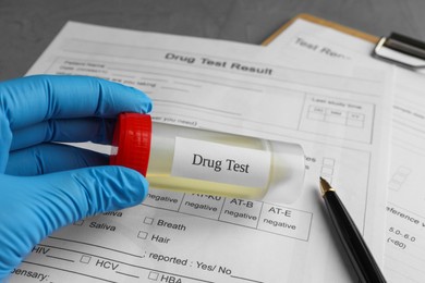 Photo of Drug test. Laboratory worker holding container with urine sample over medical forms on table, closeup
