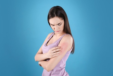 Photo of Young woman scratching hand on color background. Allergies symptoms
