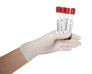 Photo of Scientist holding tubes with blood samples for hepatitis virus test on white background, closeup