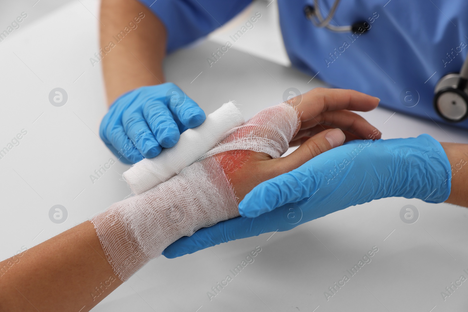 Photo of Doctor bandaging patient's burned hand at table, closeup