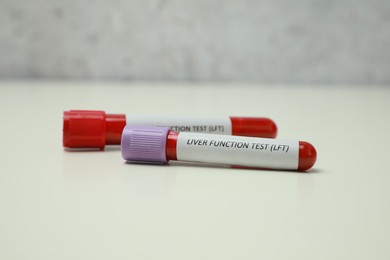 Photo of Liver Function Test. Tubes with blood samples on white table