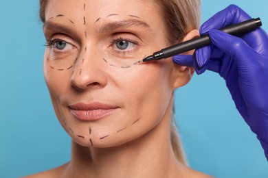 Photo of Doctor with marker preparing patient for cosmetic surgery operation on light blue background, closeup