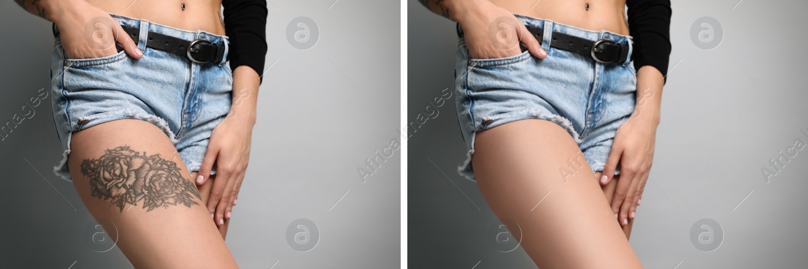 Image of Woman before and after laser tattoo removal procedure on light grey background, closeup. Collage with photos, banner design