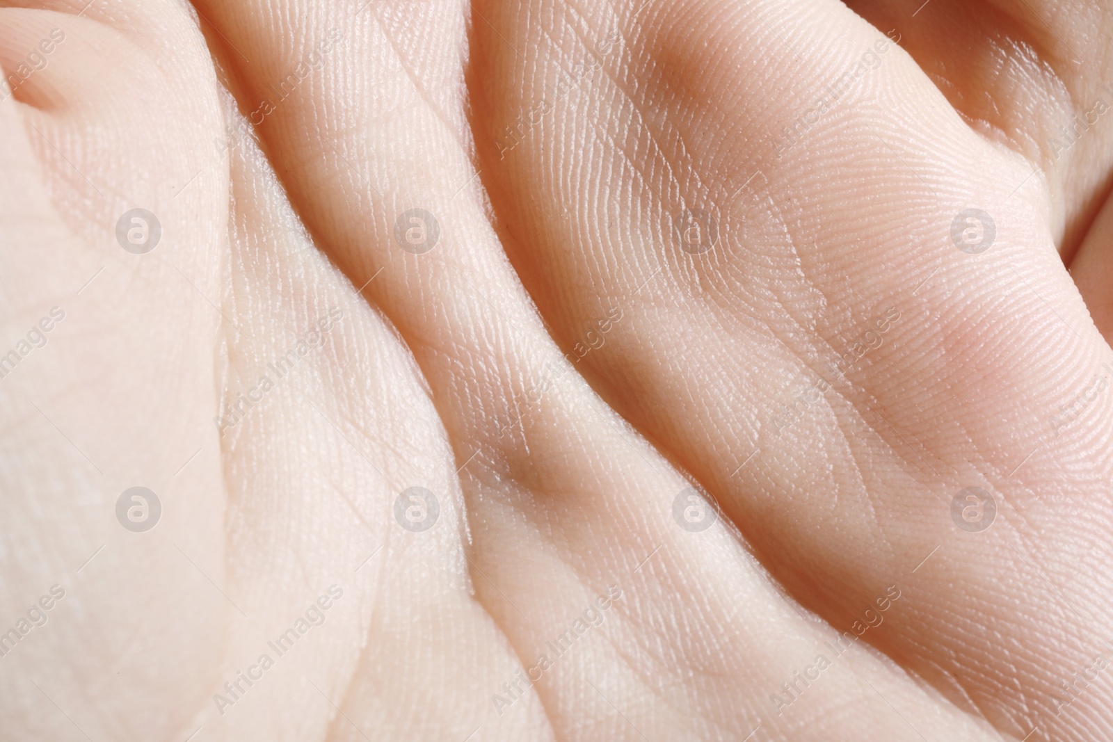 Photo of Closeup view of human hand with dry skin