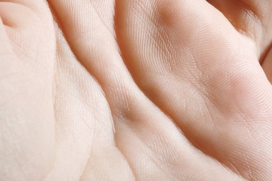 Photo of Closeup view of human hand with dry skin