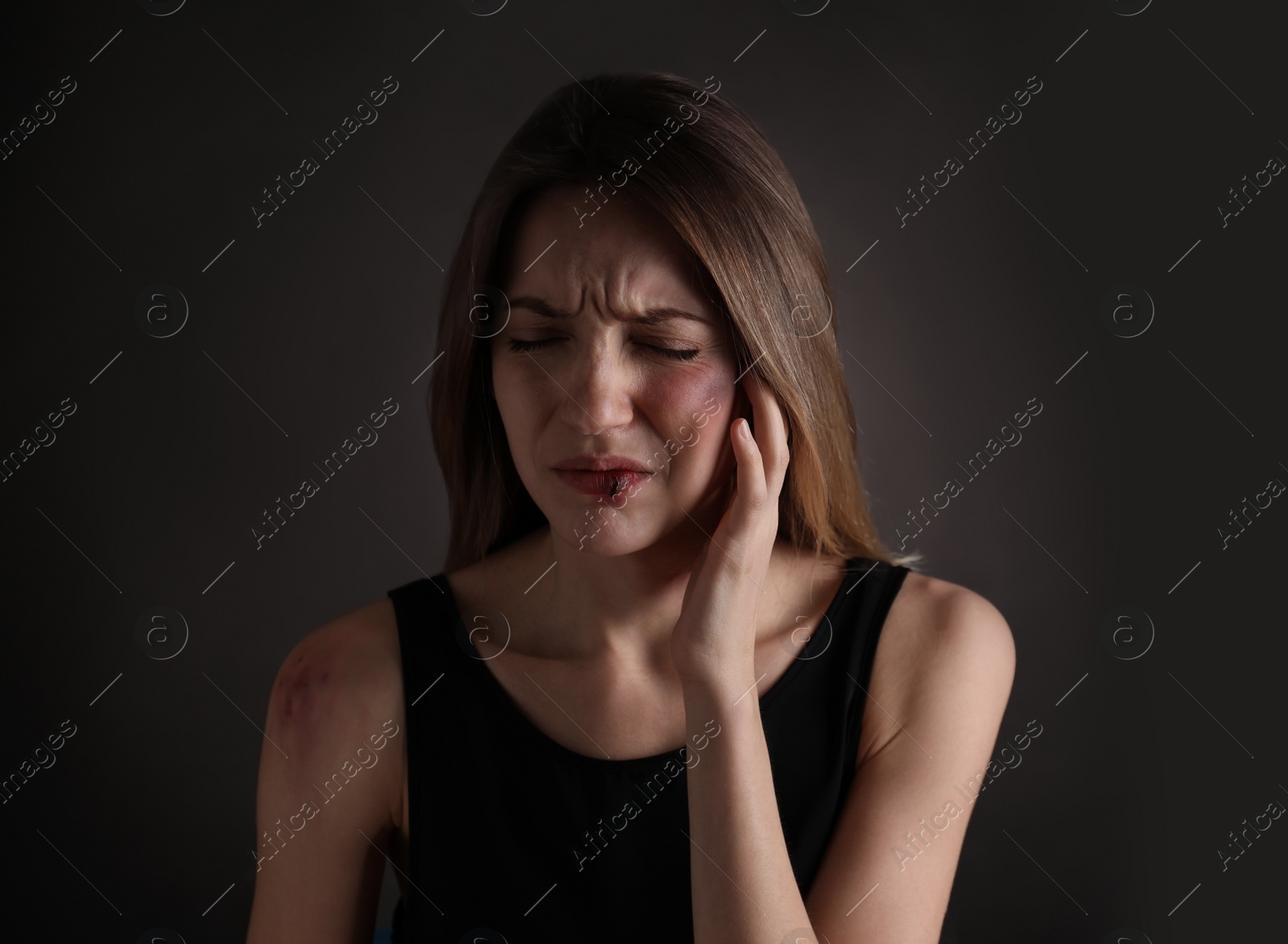 Photo of Woman with facial injuries on black background. Domestic violence victim