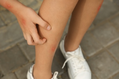 Photo of Girl scratching leg with insect bite outdoors, closeup