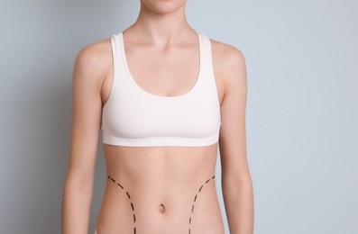 Photo of Young woman with marks on belly for cosmetic surgery operation against color background