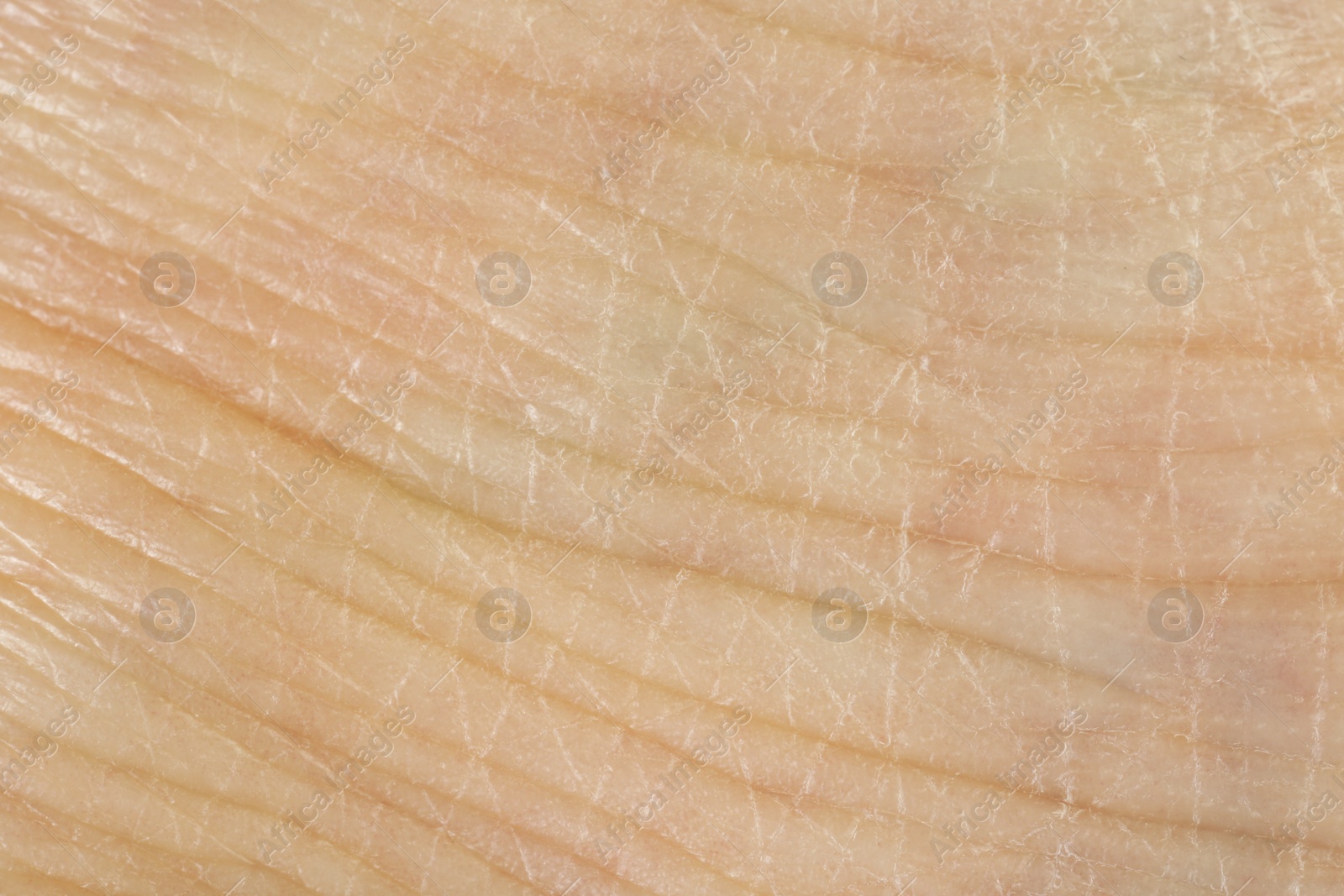 Photo of Texture of dry skin as background, macro view