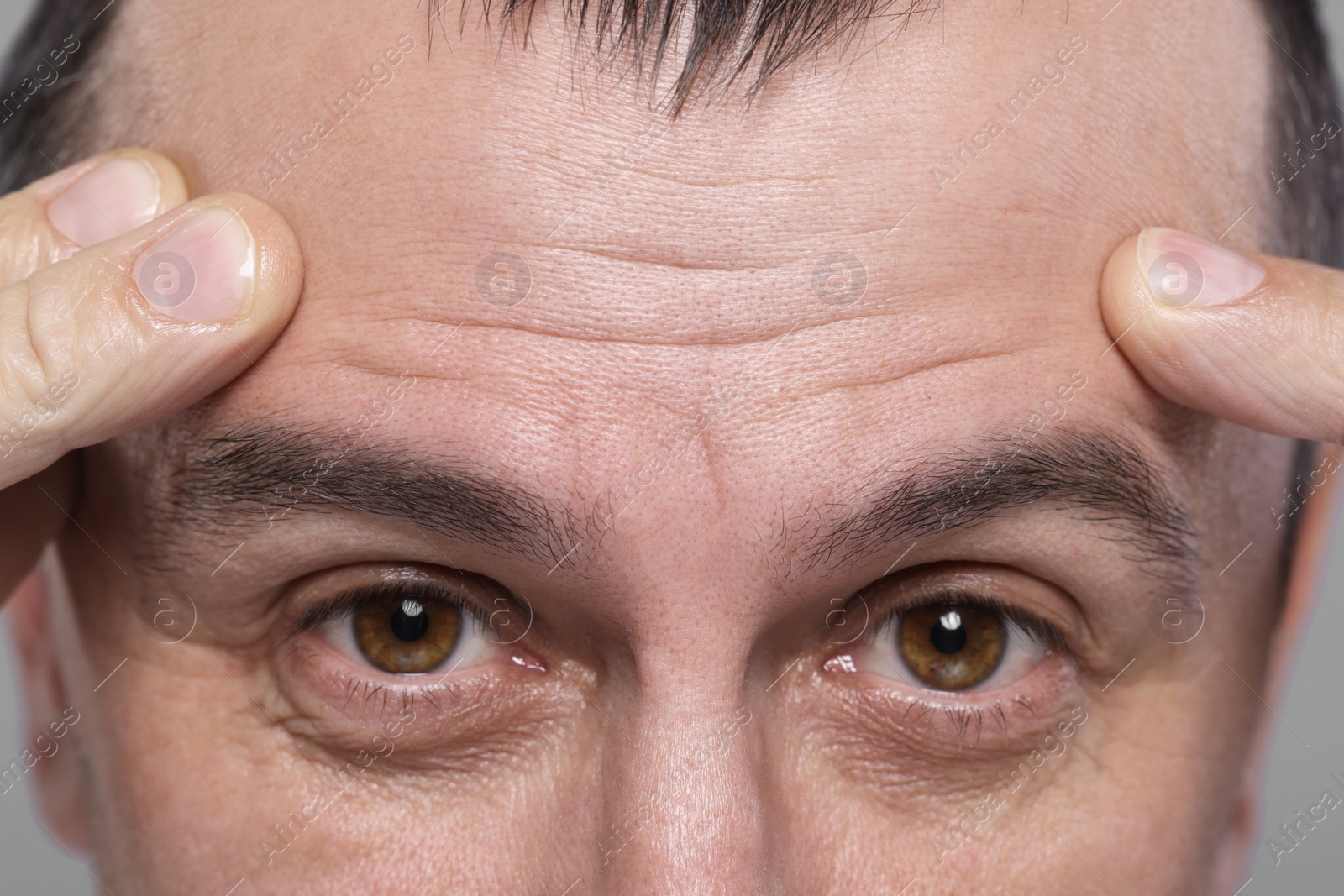 Photo of Closeup view of man with wrinkles on his forehead