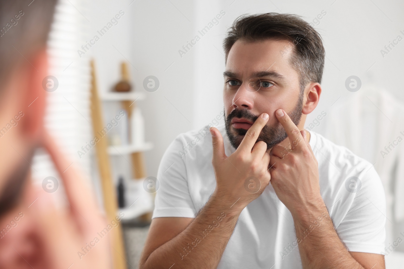 Photo of Confused man with skin problem looking at mirror indoors